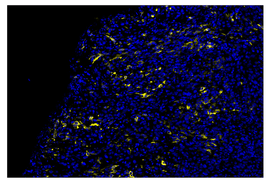 Immunohistochemistry Image 3: iNOS (E1W4J) & CO-0179-488 SignalStar<sup>™</sup> Oligo-Antibody Pair