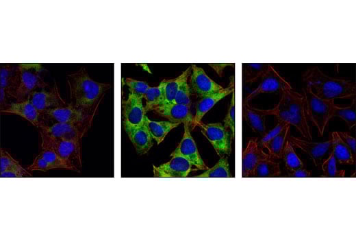 Immunofluorescence Image 1: Phospho-S6 Ribosomal Protein (Ser235/236) (2F9) Rabbit Monoclonal Antibody (BSA and Azide Free)