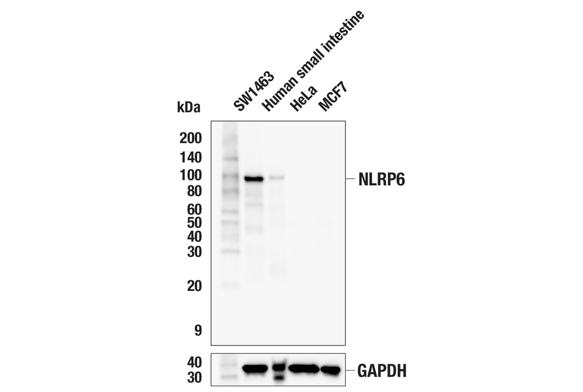 Western Blotting Image 1: NLRP6 (E2S8A) Rabbit mAb