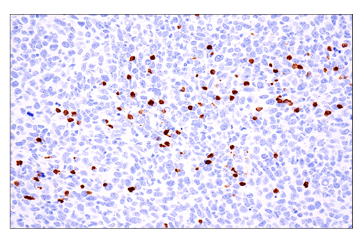 Immunohistochemistry Image 1: S100A8 (E4F8V) Rabbit Monoclonal Antibody