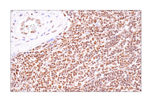 Immunohistochemistry Image 4: BRD4 (E2A7X) Rabbit Monoclonal Antibody