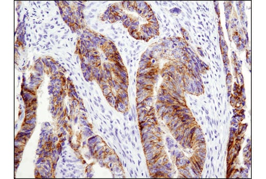undefined Image 25: Epithelial-Mesenchymal Transition (EMT) Antibody Sampler Kit