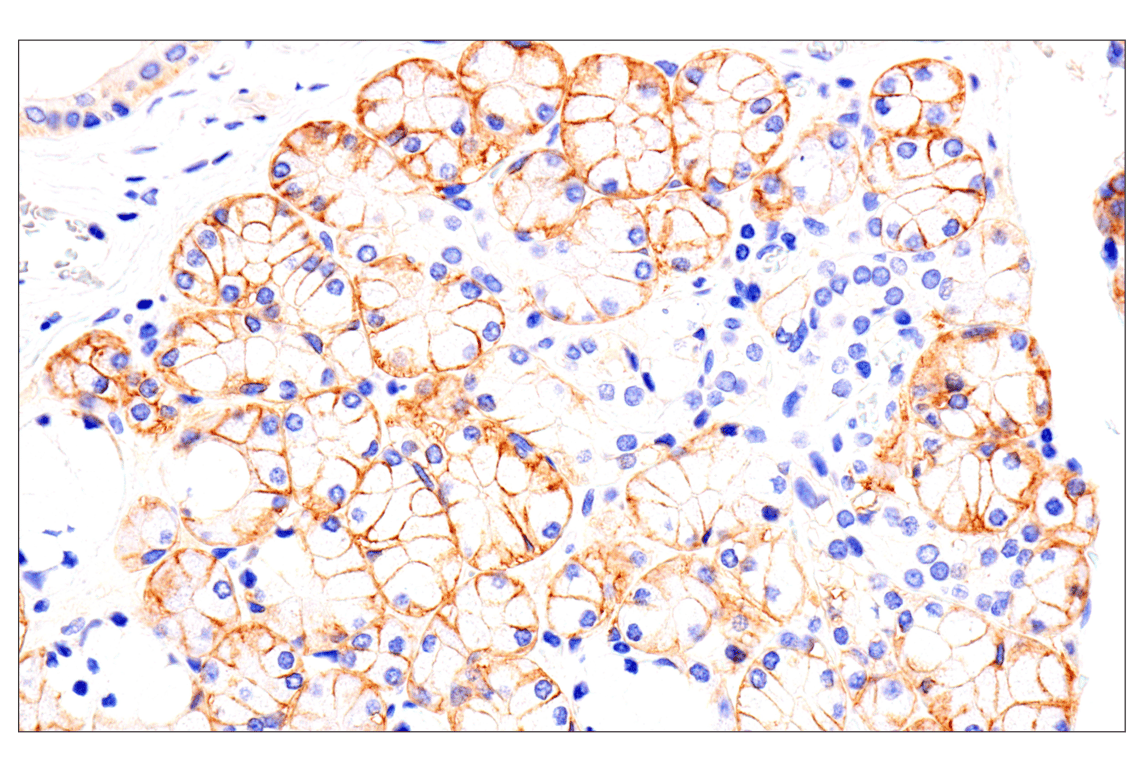 Immunohistochemistry Image 2: EphA2 (D4A2) XP<sup>®</sup> Rabbit mAb (BSA and Azide Free)