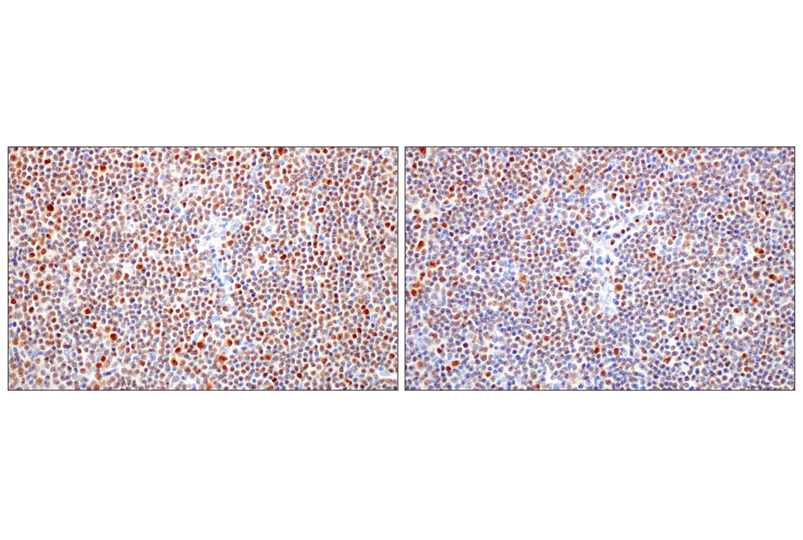 Immunohistochemistry Image 12: T-bet/TBX21 (E4I2K) Rabbit Monoclonal Antibody (BSA and Azide Free)