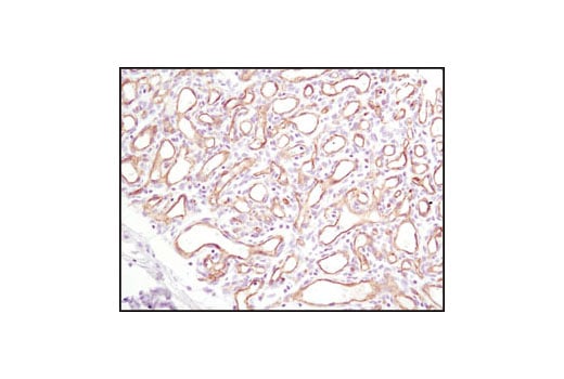 専用　cd31枚 CD31 (PECAM-1) (D8V9E) XP® Rabbit mAb (Alexa Fluor® 647
