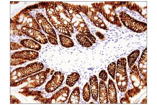 Immunohistochemistry Image 1: EpCAM (E6V8Y) Rabbit Monoclonal Antibody (BSA and Azide Free)