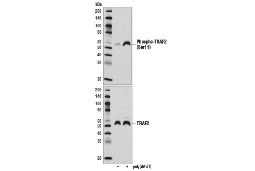 Western Blotting Image 1: Phospho-TRAF2 (Ser11) (E2B6L) Rabbit mAb