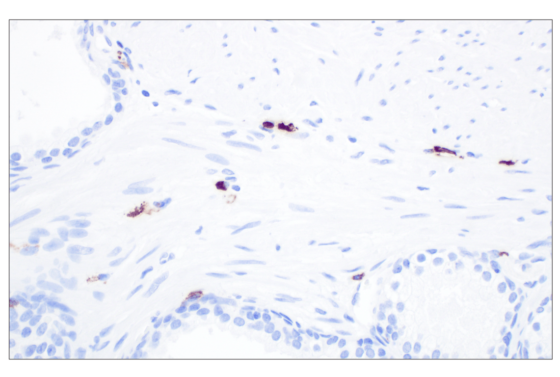 Immunohistochemistry Image 2: Mast Cell Chymase/CMA1 (F6S4Q) Rabbit Monoclonal Antibody