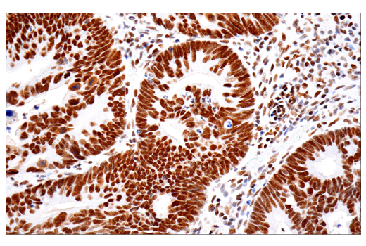 Immunohistochemistry Image 2: PBRM1/BAF180 (D4L9X) Rabbit Monoclonal Antibody