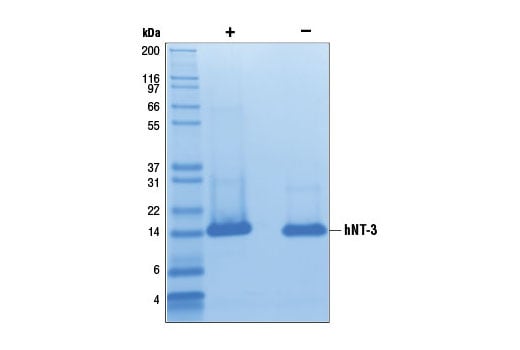 undefined Image 3: Human Neurotrophin-3 (hNT-3)