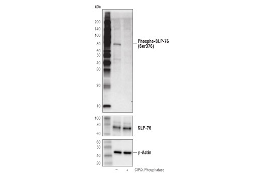Western Blotting Image 2: Phospho-SLP-76 (Ser376) (D7S1K) Rabbit Monoclonal Antibody (BSA and Azide Free)