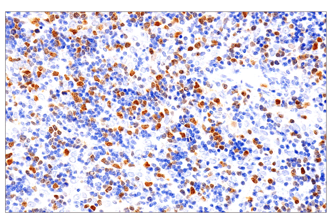 undefined Image 15: Phospho-Chk1/2 Antibody Sampler Kit