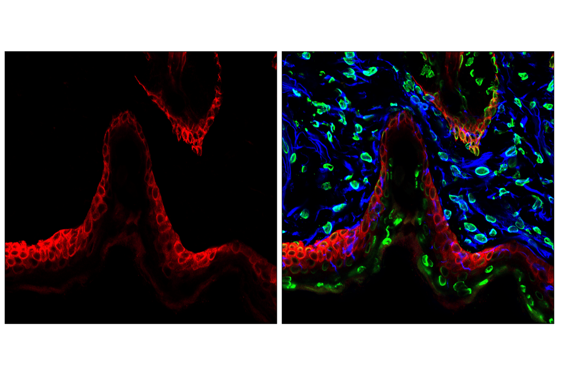 Immunofluorescence Image 1: Keratin 5 (E2T4B) Rabbit Monoclonal Antibody (Alexa Fluor<sup>®</sup> 555 Conjugate)
