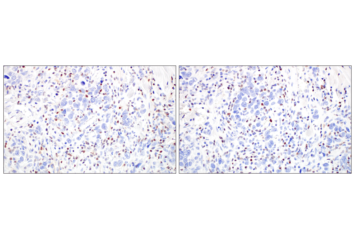 Immunohistochemistry Image 11: T-bet/TBX21 (E4I2K) Rabbit Monoclonal Antibody (BSA and Azide Free)
