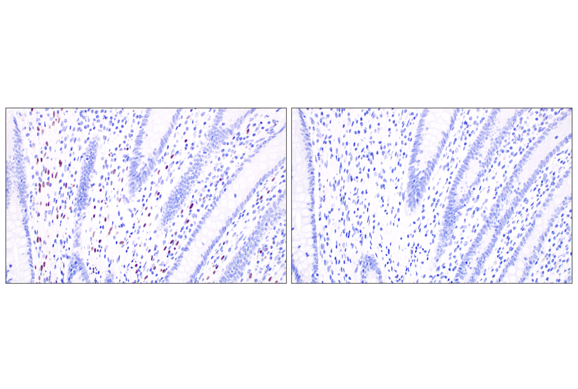 Immunohistochemistry Image 10: Sox10 (E2V9N) Rabbit Monoclonal Antibody (BSA and Azide Free)