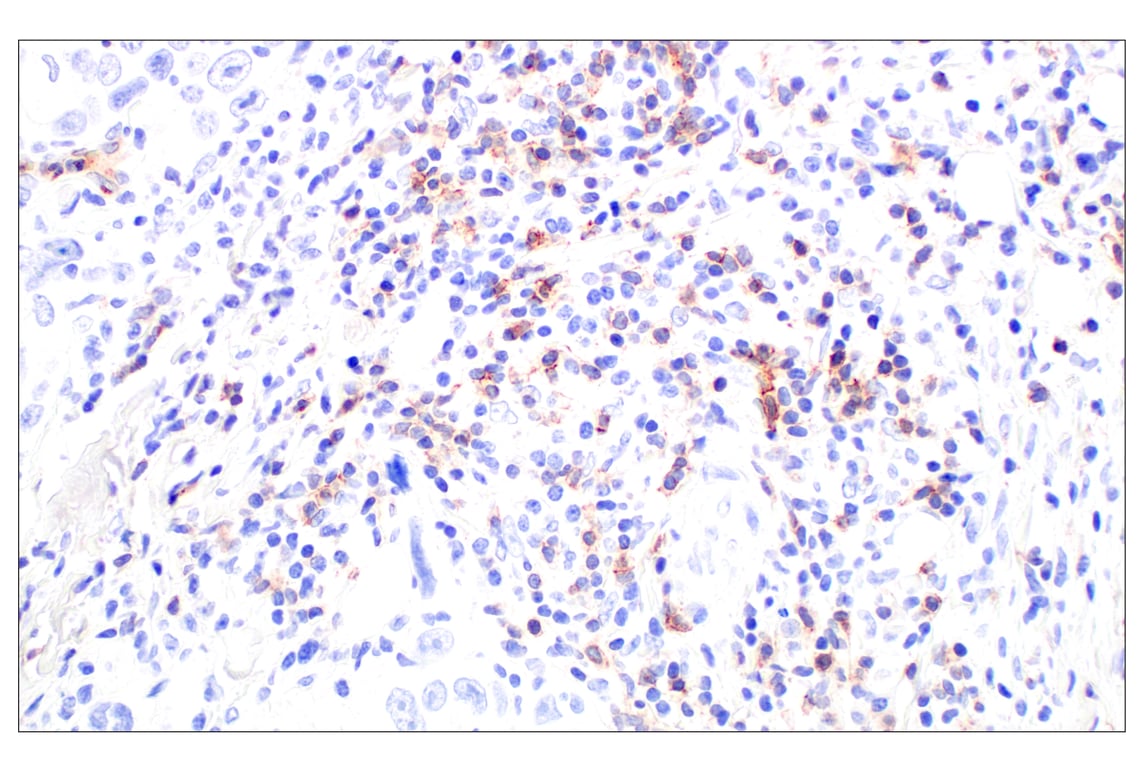 Immunohistochemistry Image 5: CD62L/L-Selectin (E7X9I) Rabbit Monoclonal Antibody