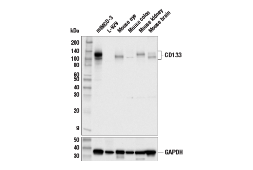 Western Blotting Image 1: CD133 (E5E2H) Rabbit mAb