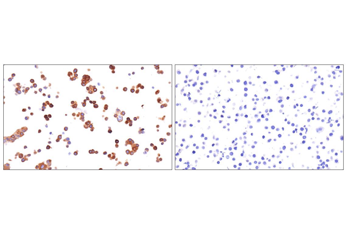 Immunohistochemistry Image 4: KK-LC-1 (F3U6C) Rabbit Monoclonal Antibody
