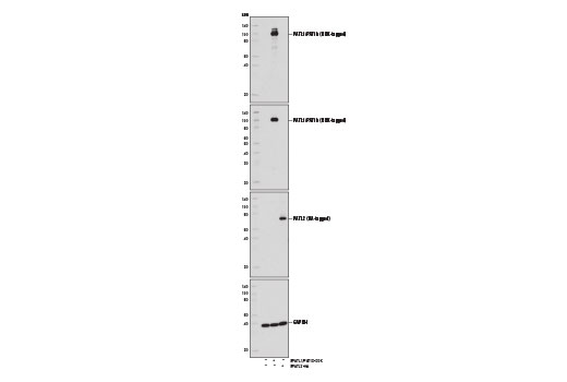 Western Blotting Image 2: PATL1/PAT1b (D8P1B) Rabbit Monoclonal Antibody