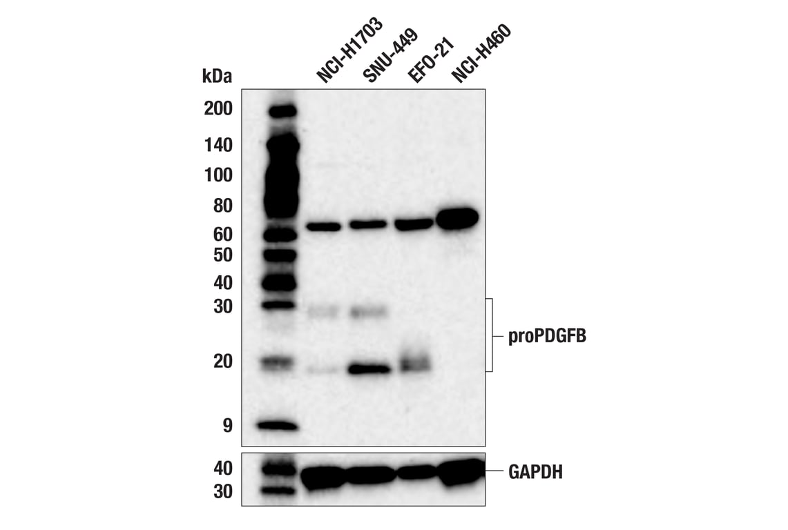 Western Blotting Image 1: PDGFB (F7P5P) Rabbit Monoclonal Antibody