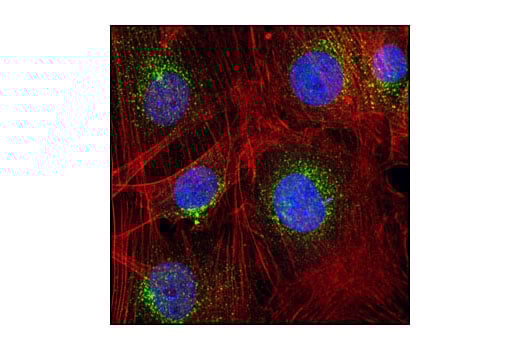 Immunofluorescence Image 1: EEA1 Antibody