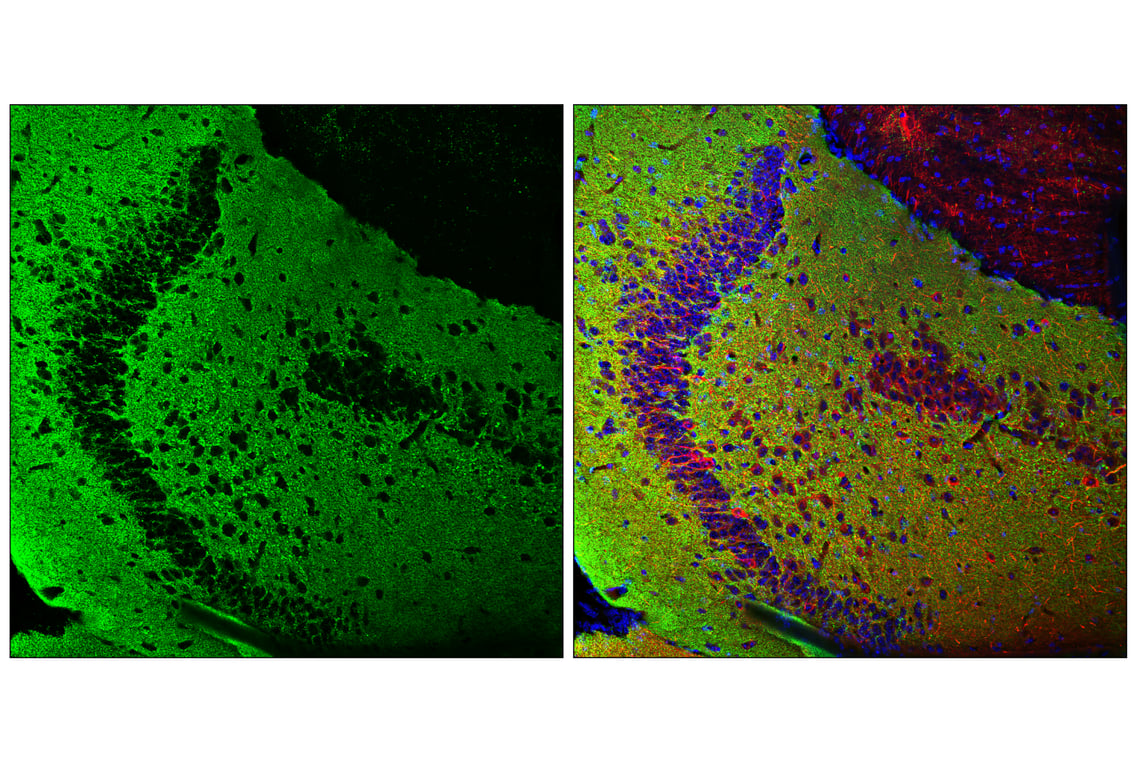 Immunofluorescence Image 2: VGLUT1 (E8L5B) Rabbit Monoclonal Antibody