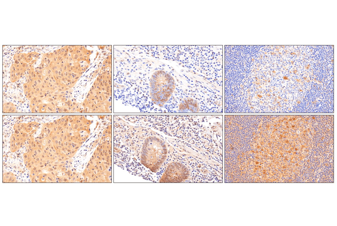 Immunohistochemistry Image 11: Phospho-Stat3 (Ser727) (D4X3C) Rabbit Monoclonal Antibody