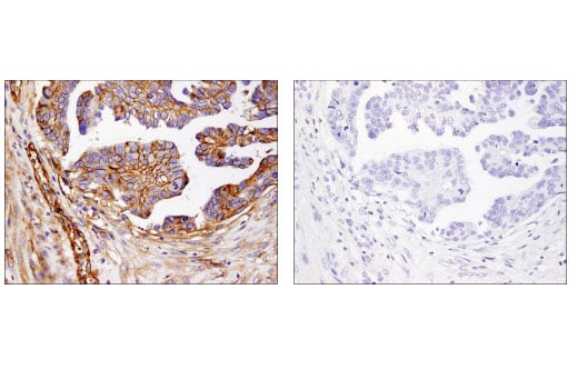 Immunohistochemistry Image 3: B7-H3 (D9M2L) Rabbit Monoclonal Antibody