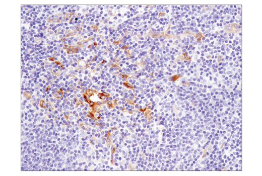 Immunohistochemistry Image 2: IFIT1 (D2X9Z) Rabbit Monoclonal Antibody (BSA and Azide Free)