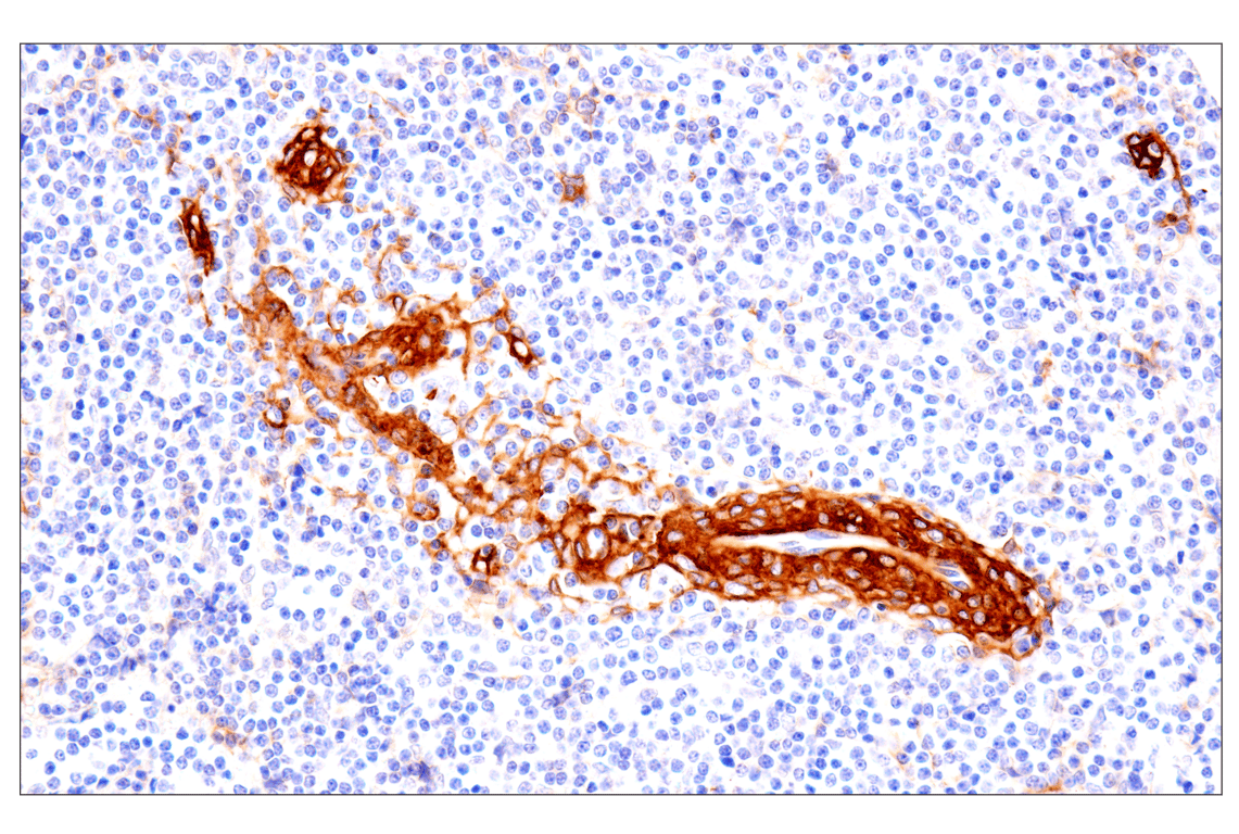 Immunohistochemistry Image 5: p75NTR (E7I3M) Rabbit Monoclonal Antibody (BSA and Azide Free)