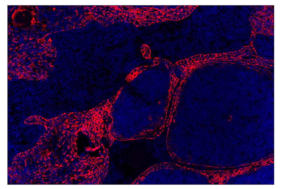 Immunohistochemistry Image 2: Keratin 17/19 (D4G2) Rabbit Monoclonal Antibody (Alexa Fluor<sup>®</sup> 555 Conjugate)