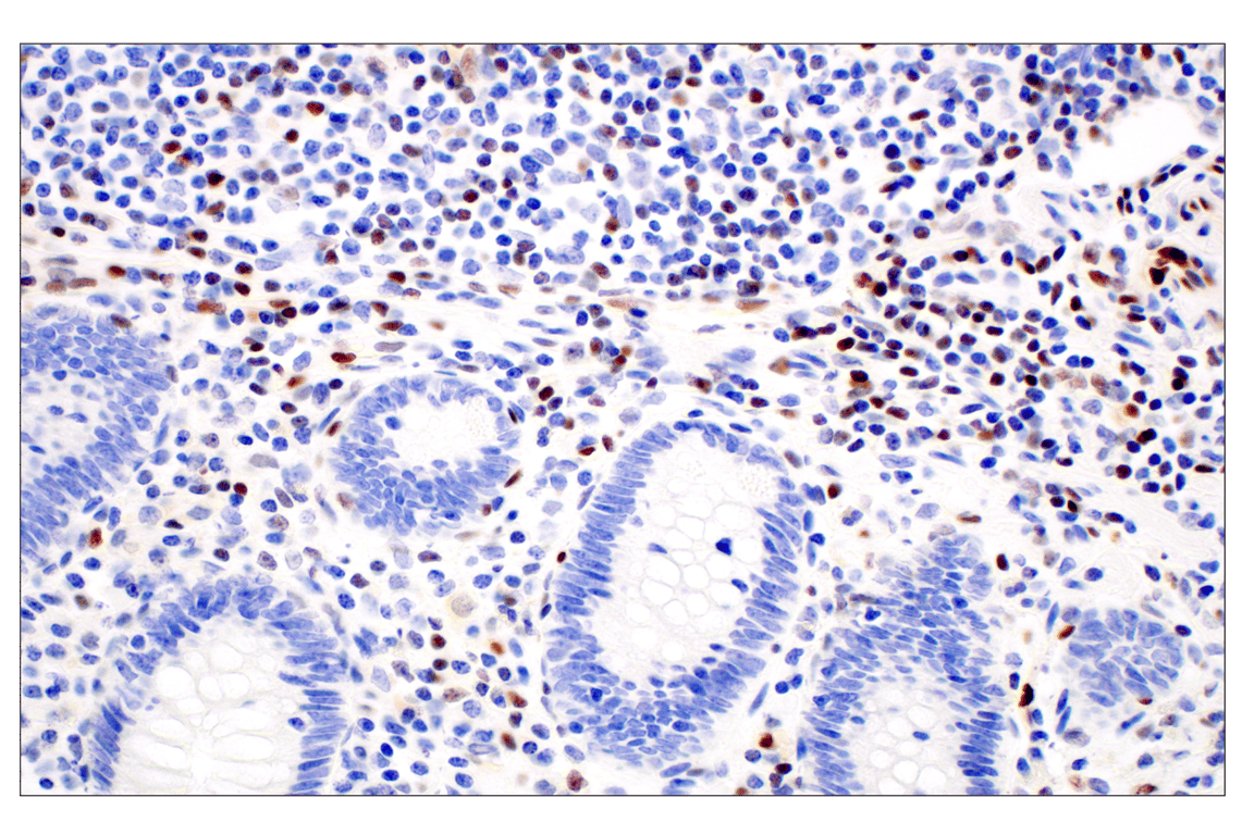Immunohistochemistry Image 4: KLF2 (E7K8Y) Rabbit Monoclonal Antibody