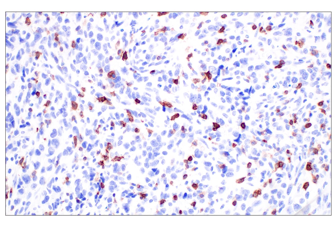 Immunohistochemistry Image 3: CD5 (E6N9S) Rabbit Monoclonal Antibody (BSA and Azide Free)