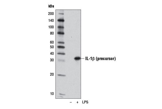 Western Blotting Image 1: IL-1β (D3H1Z) Rabbit mAb