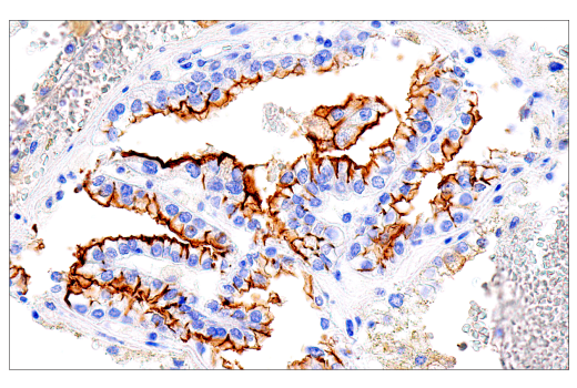 undefined Image 14: SARS-CoV-2 Virus-Host Interaction Antibody Sampler Kit