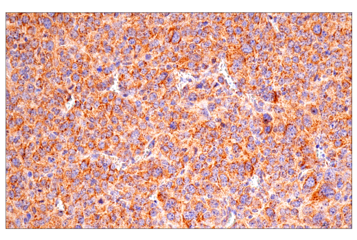 Immunohistochemistry Image 8: SDHB (E3H9Z) Rabbit Monoclonal Antibody