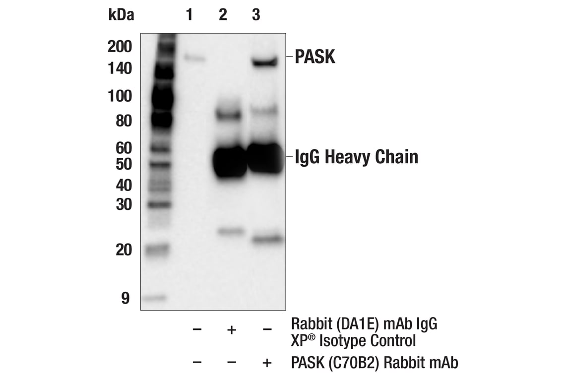 Immunoprecipitation Image 1: PASK (C70B2) Rabbit Monoclonal Antibody