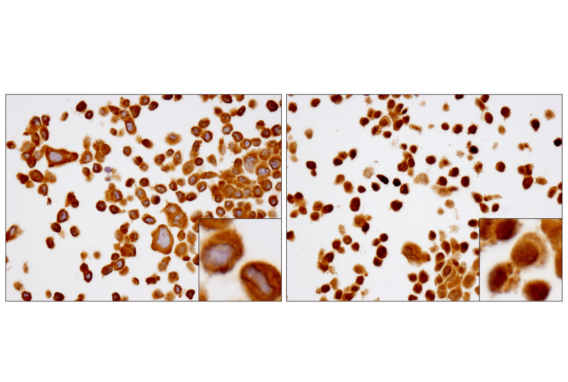 undefined Image 29: NF-κB Pathway Antibody Sampler Kit