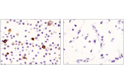 インドミティーラ画Ｃ CD11c (D1V9Y) Rabbit mAb | Cell Signaling Technology