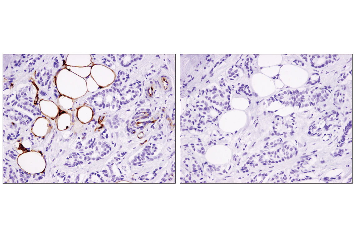 Immunohistochemistry Image 2: CD36 (D8L9T) Rabbit Monoclonal Antibody (BSA and Azide Free)