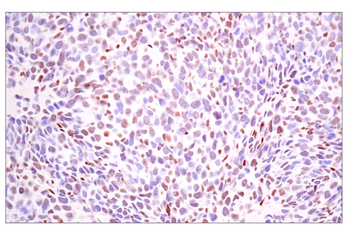 Immunohistochemistry Image 10: TLE3 (E4F3Y) Rabbit Monoclonal Antibody