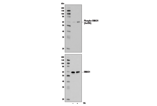 Western Blotting Image 2: Phospho-SMAD1 (Ser206) (D40B7) Rabbit Monoclonal Antibody