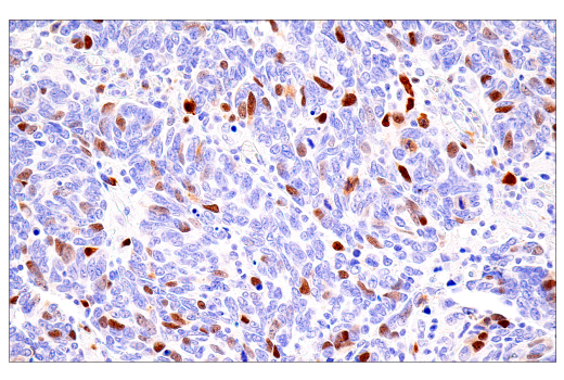 Immunohistochemistry Image 6: Cyclin A2 (E6D1J) Rabbit Monoclonal Antibody