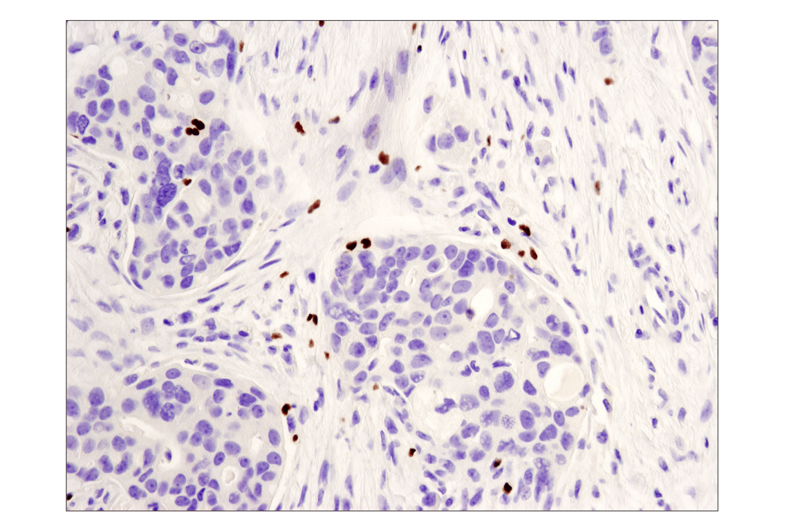 Immunohistochemistry Image 1: FoxP3 (D2W8E<sup>™</sup>) Rabbit mAb