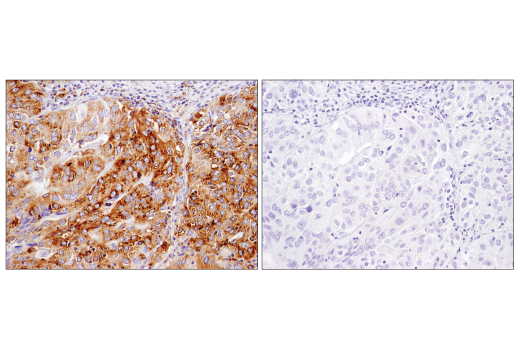 Immunohistochemistry Image 3: MX1 (D3W7I) Rabbit Monoclonal Antibody (BSA and Azide Free)