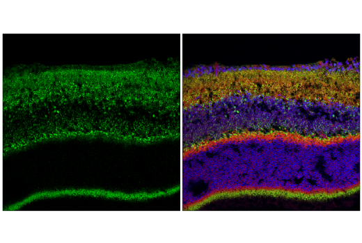 Immunofluorescence Image 1: MCU (D2Z3B) Rabbit Monoclonal Antibody