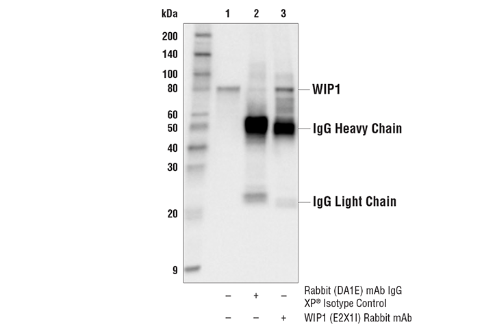 Immunoprecipitation Image 1: WIP1 (E2X1I) Rabbit Monoclonal Antibody