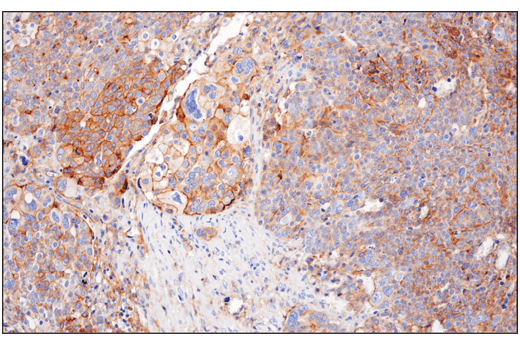 Immunohistochemistry Image 2: Nectin-2/CD112 (D8D3F) Rabbit Monoclonal Antibody (BSA and Azide Free)