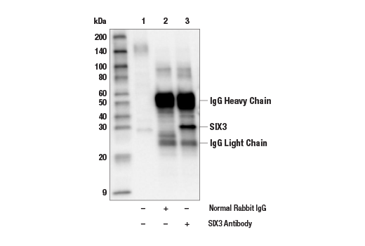 Immunoprecipitation Image 1: SIX3 Antibody