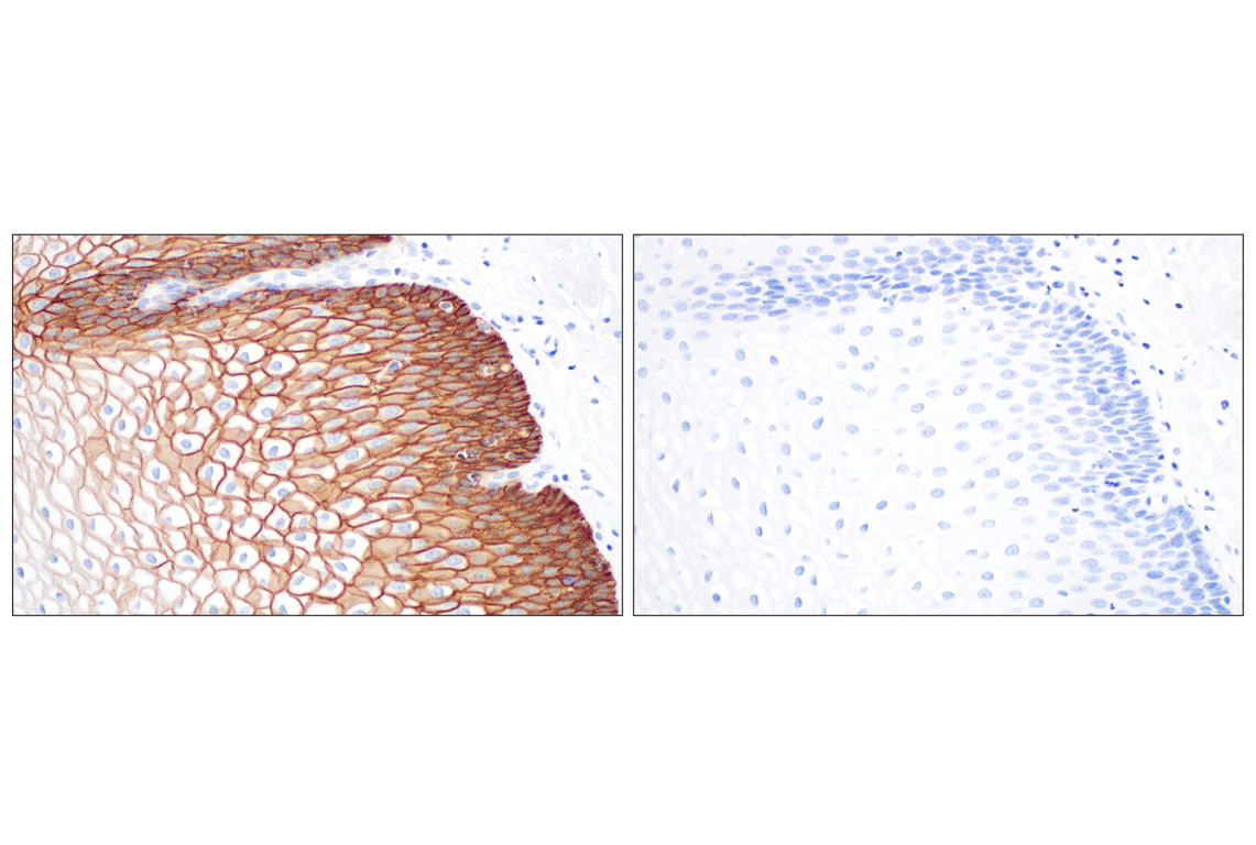 Immunohistochemistry Image 8: CD44 v6 (C44Mab-9) Mouse Monoclonal Antibody